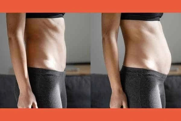 LA-EMS Body Sculpting results Kingston Vale