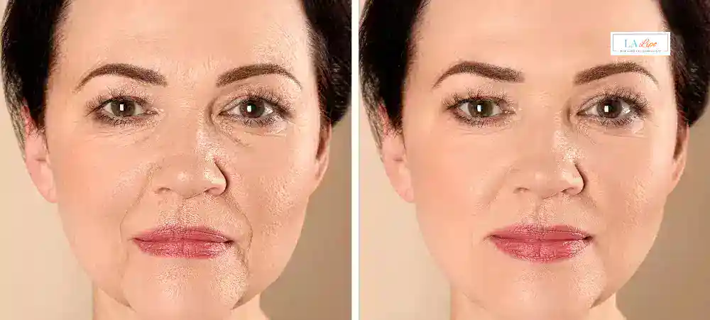 Why Aren’t My Skincare Products Making My Sagging Skin Look Firmer Kingston Vale?