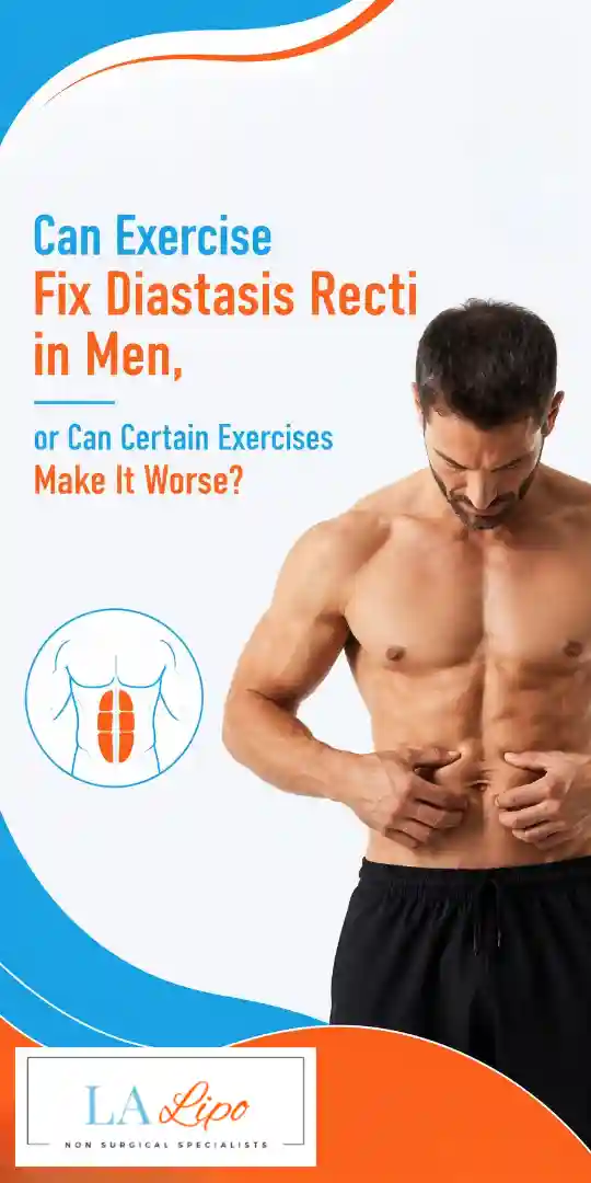 Can Exercise Fix Diastasis Recti in Men, or Can Certain Exercises Make It Worse Kingston Vale?