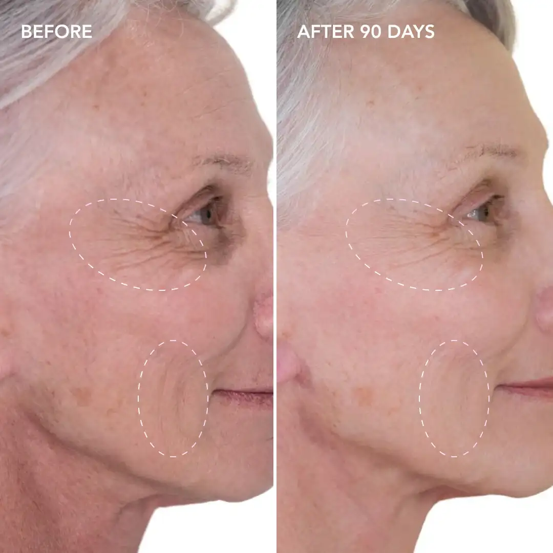 When will you see results Kingston Vale